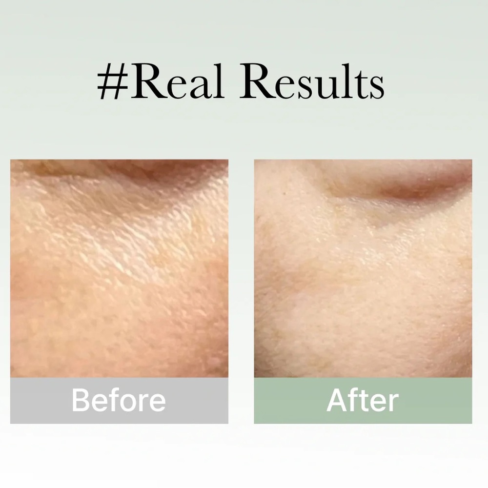 177. Arencia Holy Hyssop Serum- overnight facial serum, brighten, reduce scars - Picture 4 of 8